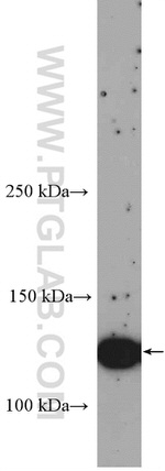 ERBB4 Antibody in Western Blot (WB)