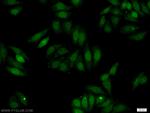 ERBB4 Antibody in Immunocytochemistry (ICC/IF)