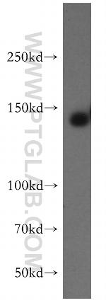 ERBB4 Antibody in Western Blot (WB)