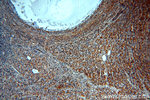 GNRHR Antibody in Immunohistochemistry (Paraffin) (IHC (P))