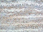 GNRHR Antibody in Immunohistochemistry (Paraffin) (IHC (P))