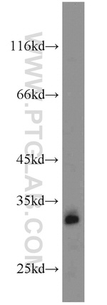 GNRHR Antibody in Western Blot (WB)