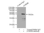 GNRHR Antibody in Immunoprecipitation (IP)