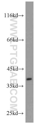 GNRHR Antibody in Western Blot (WB)