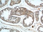 GPR22 Antibody in Immunohistochemistry (Paraffin) (IHC (P))