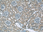 GAC Antibody in Immunohistochemistry (Paraffin) (IHC (P))