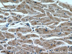 GAC Antibody in Immunohistochemistry (Paraffin) (IHC (P))