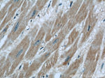 GAC Antibody in Immunohistochemistry (Paraffin) (IHC (P))