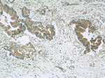 GAC Antibody in Immunohistochemistry (Paraffin) (IHC (P))