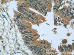 GAC Antibody in Immunohistochemistry (Paraffin) (IHC (P))