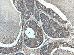 GAC Antibody in Immunohistochemistry (Paraffin) (IHC (P))