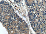 GAC Antibody in Immunohistochemistry (Paraffin) (IHC (P))