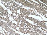 GAC Antibody in Immunohistochemistry (Paraffin) (IHC (P))