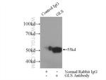 GAC Antibody in Immunoprecipitation (IP)