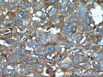 IGFBP7 Antibody in Immunohistochemistry (Paraffin) (IHC (P))