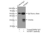 IGFBP7 Antibody in Immunoprecipitation (IP)