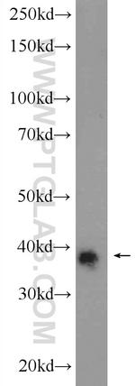 IGFBP7 Antibody in Western Blot (WB)