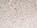 ITPR1 Antibody in Immunohistochemistry (Paraffin) (IHC (P))