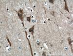 ITPR1 Antibody in Immunohistochemistry (Paraffin) (IHC (P))