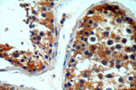 ITPR1 Antibody in Immunohistochemistry (Paraffin) (IHC (P))