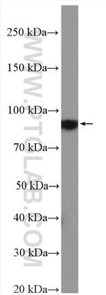 KCNQ3 Antibody in Western Blot (WB)