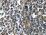 MAP3K1 Antibody in Immunohistochemistry (Paraffin) (IHC (P))