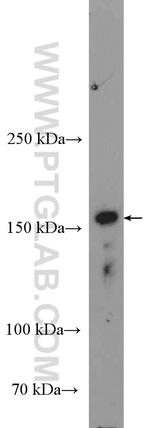 MAP3K1 Antibody in Western Blot (WB)