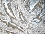 MLK2 Antibody in Immunohistochemistry (Paraffin) (IHC (P))