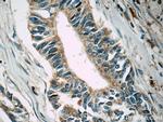 MLK2 Antibody in Immunohistochemistry (Paraffin) (IHC (P))