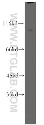 MLK2 Antibody in Western Blot (WB)