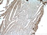 MYBPC3 Antibody in Immunohistochemistry (Paraffin) (IHC (P))