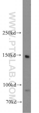 MYBPC3 Antibody in Western Blot (WB)