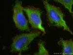 PAK2 Antibody in Immunocytochemistry (ICC/IF)