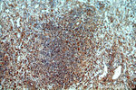 PAK2 Antibody in Immunohistochemistry (Paraffin) (IHC (P))