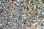 PAK2 Antibody in Immunohistochemistry (Paraffin) (IHC (P))