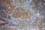 PAK2 Antibody in Immunohistochemistry (Paraffin) (IHC (P))