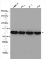 PAK2 Antibody in Western Blot (WB)