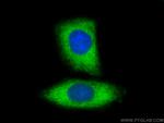 LDHA Antibody in Immunocytochemistry (ICC/IF)