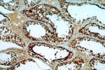 LDHA Antibody in Immunohistochemistry (Paraffin) (IHC (P))