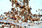 LDHA Antibody in Immunohistochemistry (Paraffin) (IHC (P))