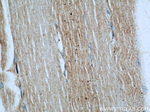 LDHA Antibody in Immunohistochemistry (Paraffin) (IHC (P))