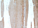 LDHA Antibody in Immunohistochemistry (Paraffin) (IHC (P))