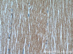 LDHA Antibody in Immunohistochemistry (Paraffin) (IHC (P))