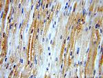 LDHA Antibody in Immunohistochemistry (Paraffin) (IHC (P))