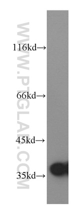 LDHA Antibody in Western Blot (WB)