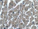 LDHB Antibody in Immunohistochemistry (Paraffin) (IHC (P))