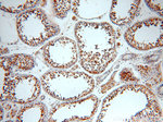 LDHC Antibody in Immunohistochemistry (Paraffin) (IHC (P))