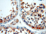 LDHC Antibody in Immunohistochemistry (Paraffin) (IHC (P))