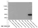 HBZ Antibody in Western Blot (WB)