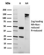 Alpha-2-Macroglobulin Antibody in SDS-PAGE (SDS-PAGE)
